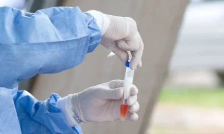 Saúde põe em sigilo valor da compra de 73 milhões de testes de Covid