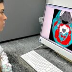 Composição corporal influencia sobrevida em pacientes com câncer de cabeça e pescoço, aponta estudo