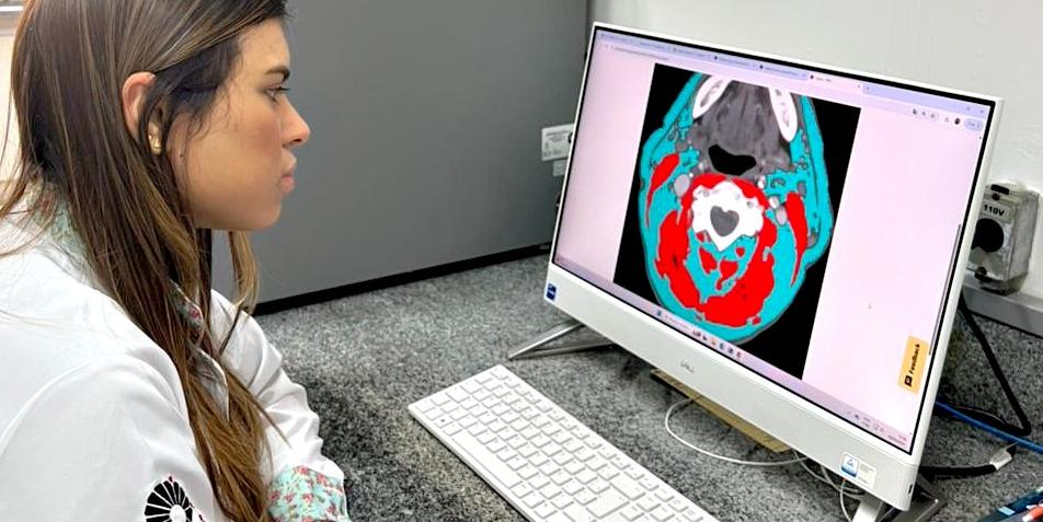 Composição corporal influencia sobrevida em pacientes com câncer de cabeça e pescoço, aponta estudo