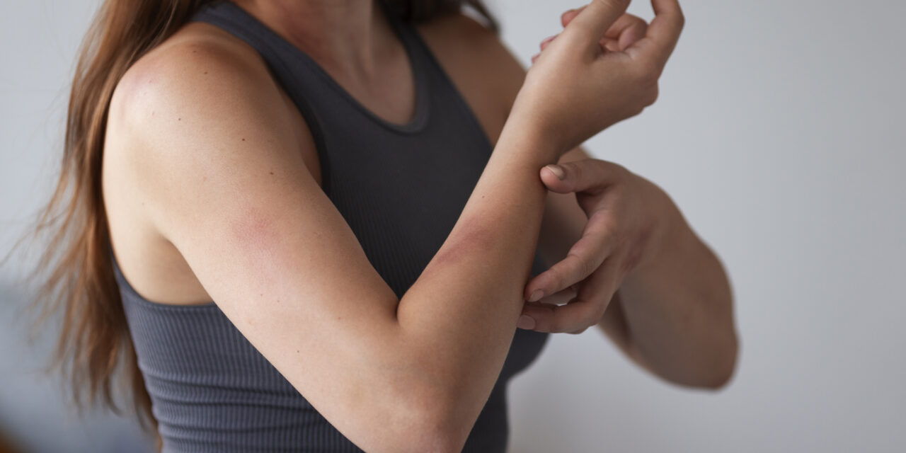 Alta de anafilaxia expõe falta de caneta de adrenalina no Brasil