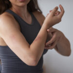 Alta de anafilaxia expõe falta de caneta de adrenalina no Brasil