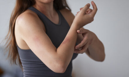 Alta de anafilaxia expõe falta de caneta de adrenalina no Brasil