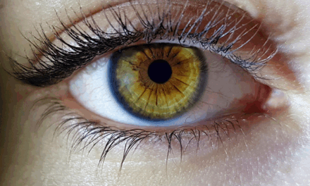 Dia Mundial do Ceratone: coçar os olhos é importante fator de risco