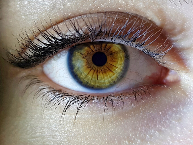 Dia Mundial do Ceratone: coçar os olhos é importante fator de risco